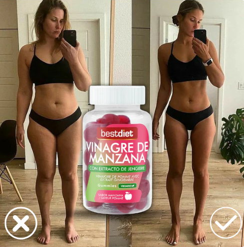 Gummies de Vinagre de Manzana – Apoyo Digestivo y Energía Natural