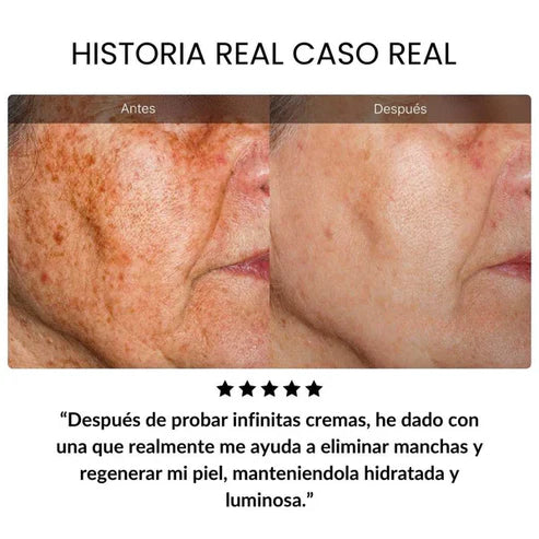 Crema hidratante antienvejecimiento con retinol placenta de dragón